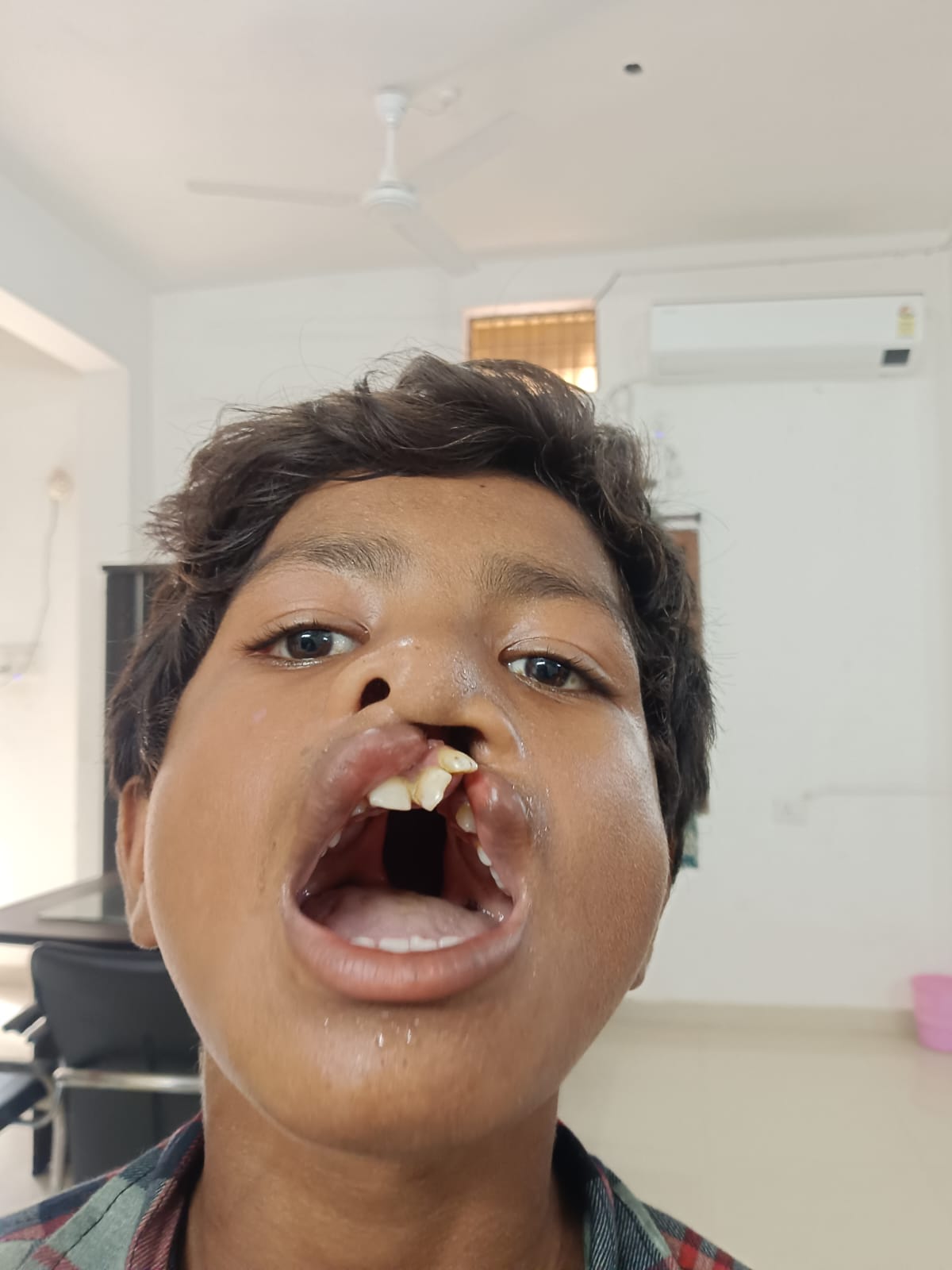 राष्ट्रीय बाल स्वास्थ्य कार्यक्रम से 15 वर्षीय माड़कम हुंगा का हुआ निःशुल्क उपचार, परिवार को मिली बड़ी राहत