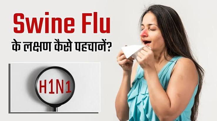 स्वाइन फ्लू की रोकथाम व बचाव के उपाय